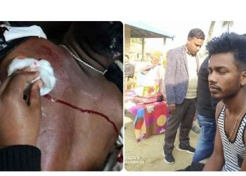 छुरा प्रहारबाट घाइते युवा न्यायका लागी भौतारीदैंँ: सिरहा प्रहरीको जिम्मेवारी फितलो