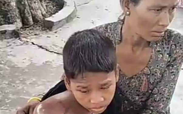 रकम अभावमा क्यान्सर संग जुध्दै १२ वर्षे बालक