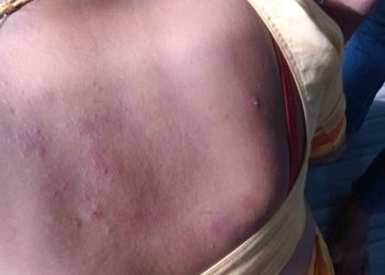 लक्ष्मीपुर चौकमा बच्चा चोरको नाउँमा तेस्रो लिङ्गीमाथी कुटपिट