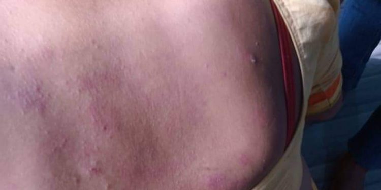 लक्ष्मीपुर चौकमा बच्चा चोरको नाउँमा तेस्रो लिङ्गीमाथी कुटपिट