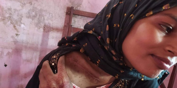 भारतको खुटौना लगेर श्रीमान मो.समरुल मियां र देवर मो. नइमले निर्घात कुटपिट: न्याय खोज्दै पीडित महिला