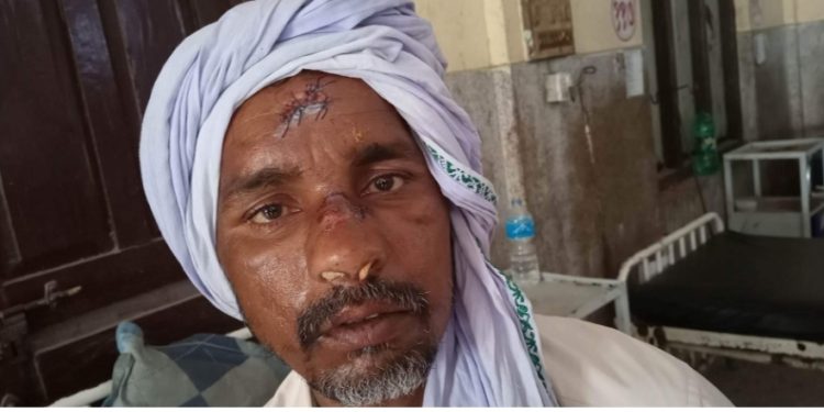 वडाध्यक्ष यादवले गरे सामुहिक कुटपिट