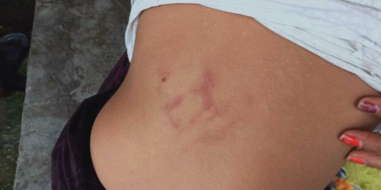 बराहक्षेत्रको जंगलमा १३ वर्षीया किशोरीमाथि कुटपिट, तीन जना पक्राउ