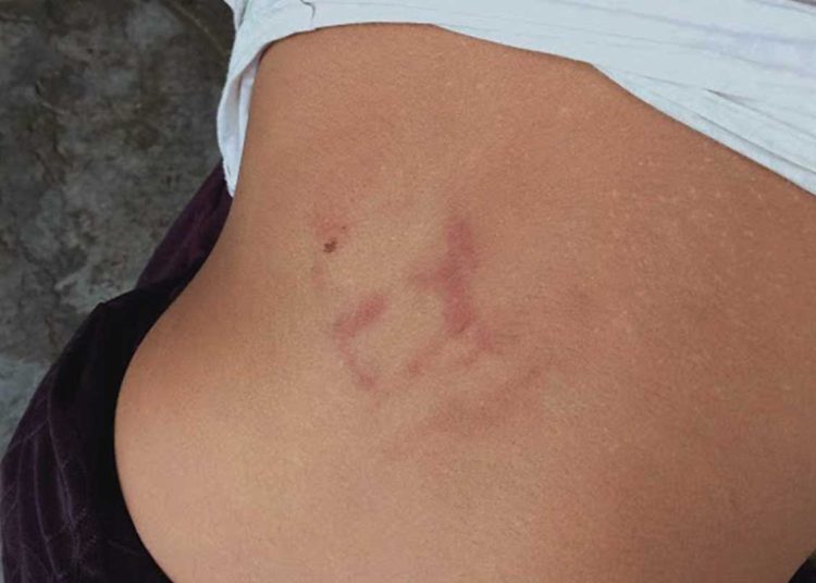 बराहक्षेत्रको जंगलमा १३ वर्षीया किशोरीमाथि कुटपिट, तीन जना पक्राउ